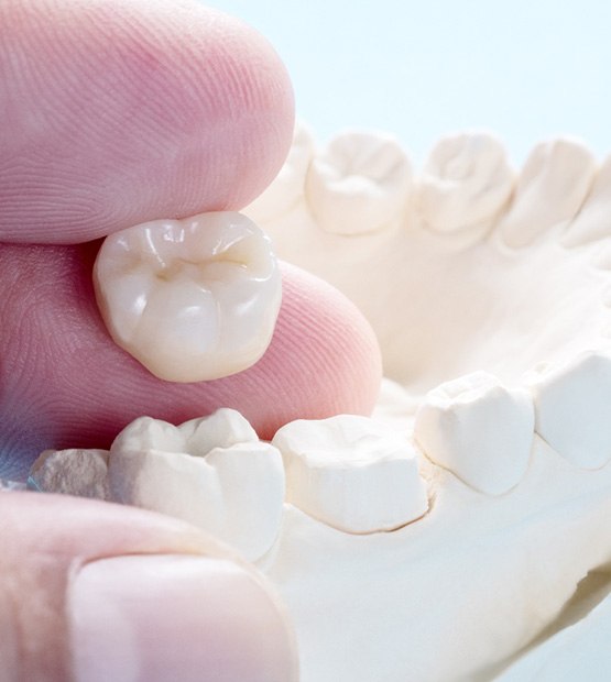 Up-close view of a hand holding a dental crown