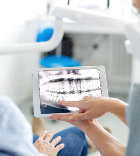 A full mouth reconstruction consultation