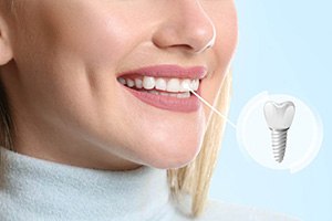 A happy, smiling woman with a completed dental implant