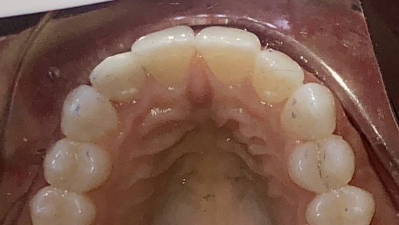 Smile with teeth in proper alignment