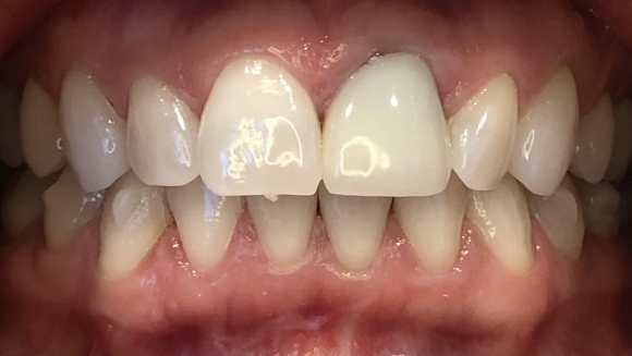 Smile before dental treatment