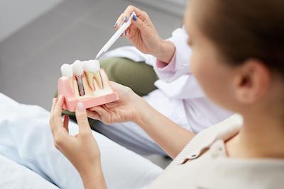 Woman looking at dental implant model, encino ca