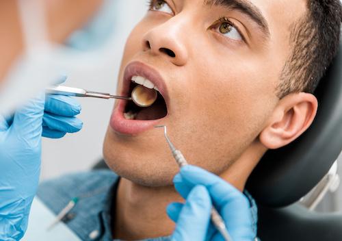 Black man getting teeth checked, encino ca