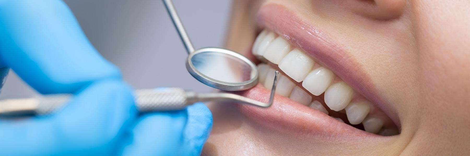 Close up photo of womens teeth, encino ca