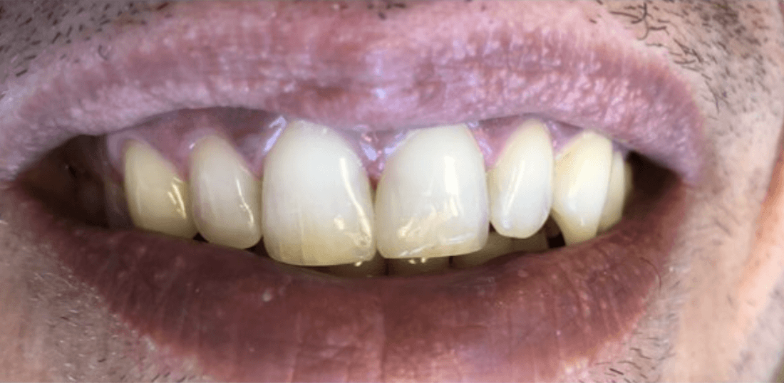 After composite bindings, encino ca